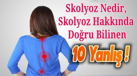 Skolyoz Nedir, Skolyoz Hakknda Doru Bilinen 10 Yanl !